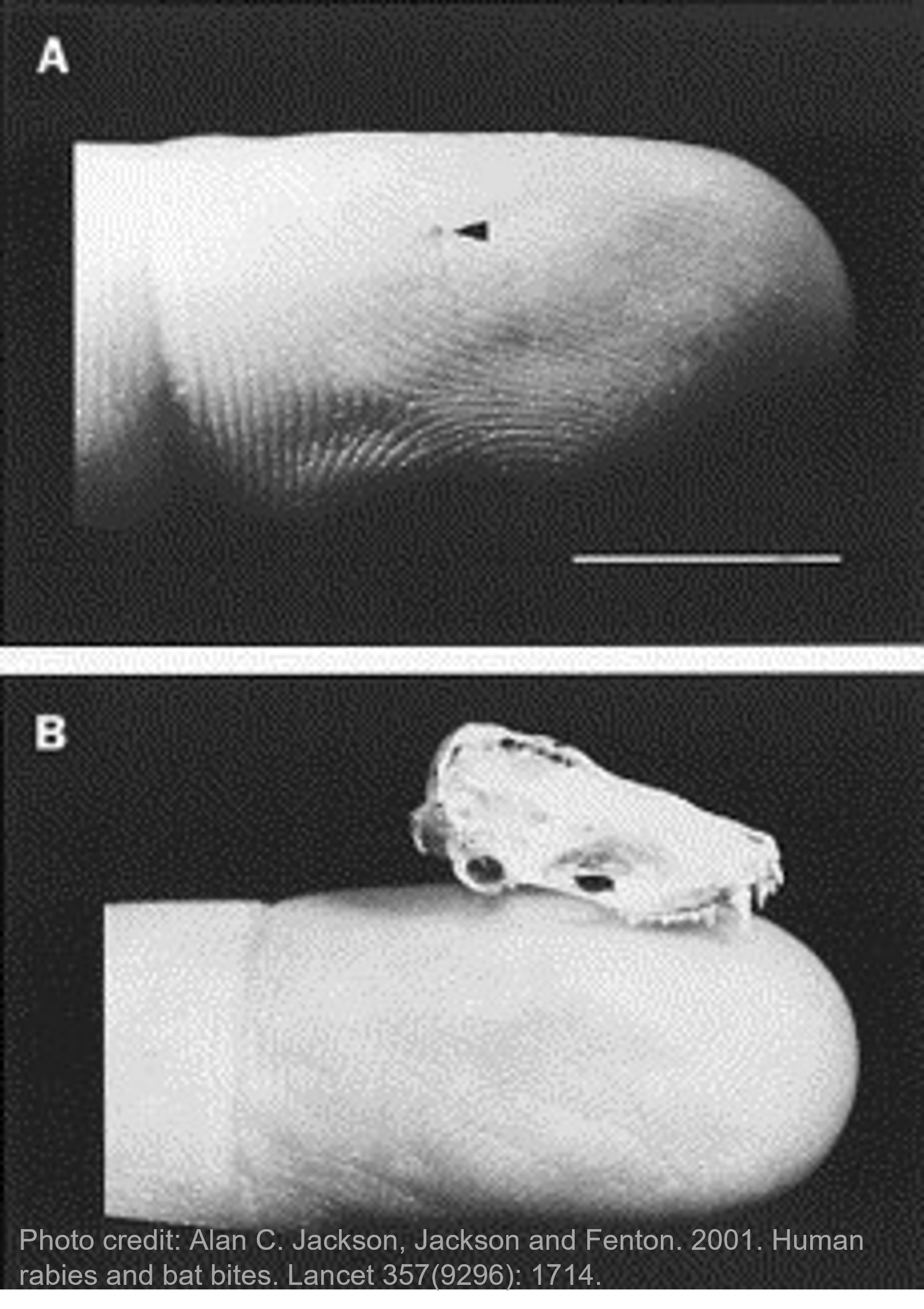 Finger with a small bat bite, and a bat skull on an index finger