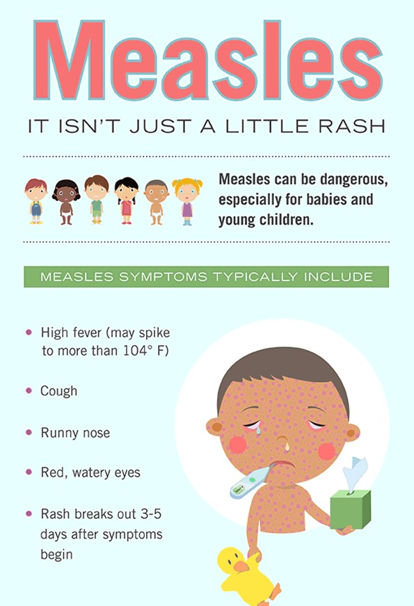 Measles Disease Surveillance Epidemiology Program MeCDC; DHHS Maine
